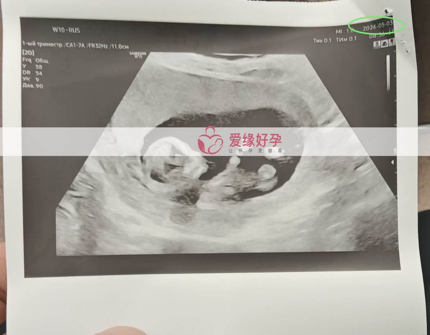 爱缘好孕:哈萨克斯坦爱心妈妈12周孕检顺利通过