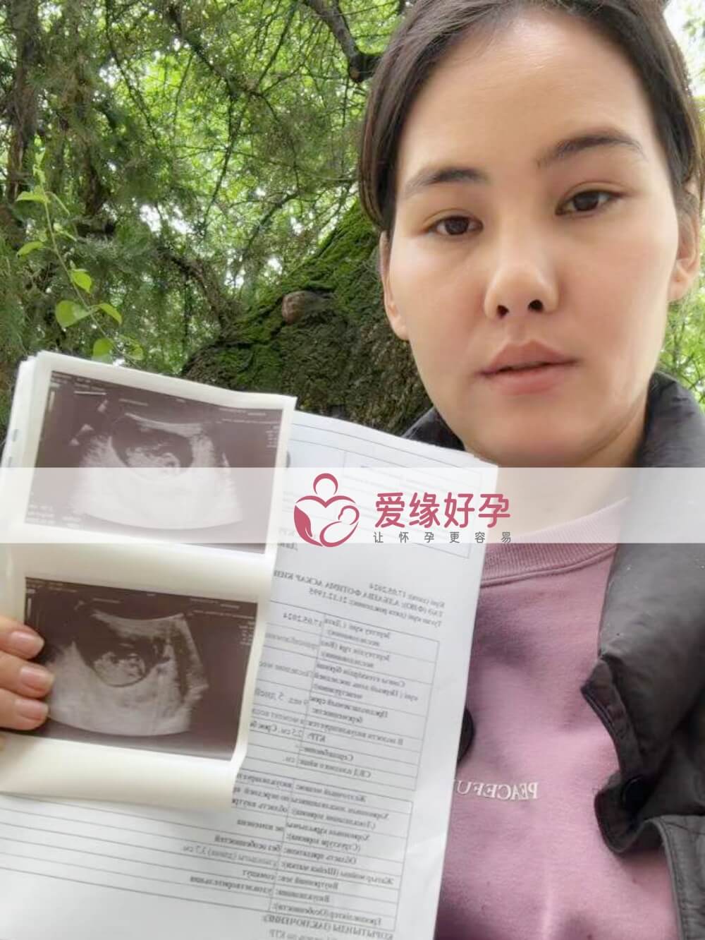 爱缘好孕:哈萨克斯坦爱心妈妈9周孕检通过