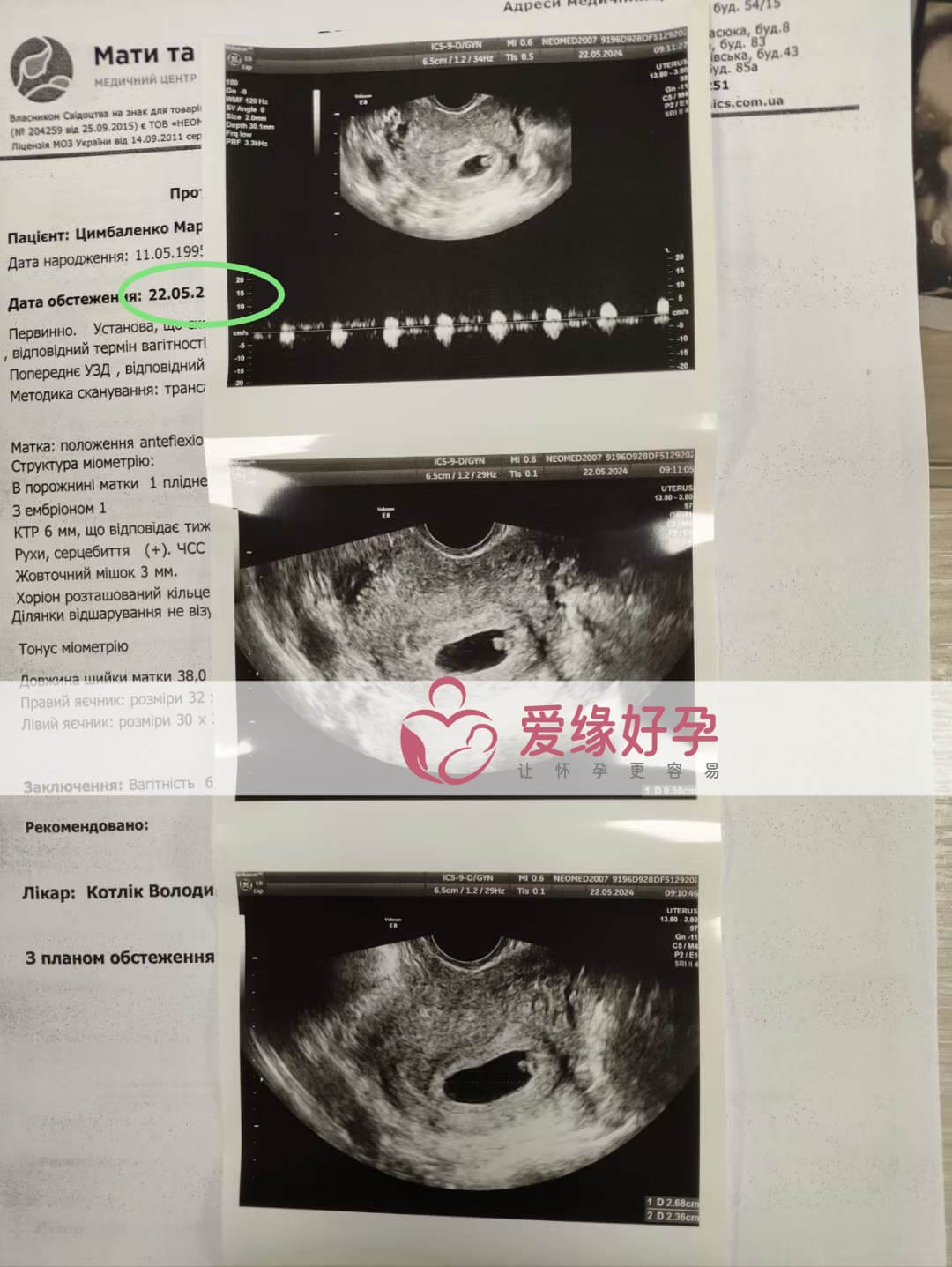 爱缘好孕:乌克兰爱心妈妈孕6周产检顺利通过