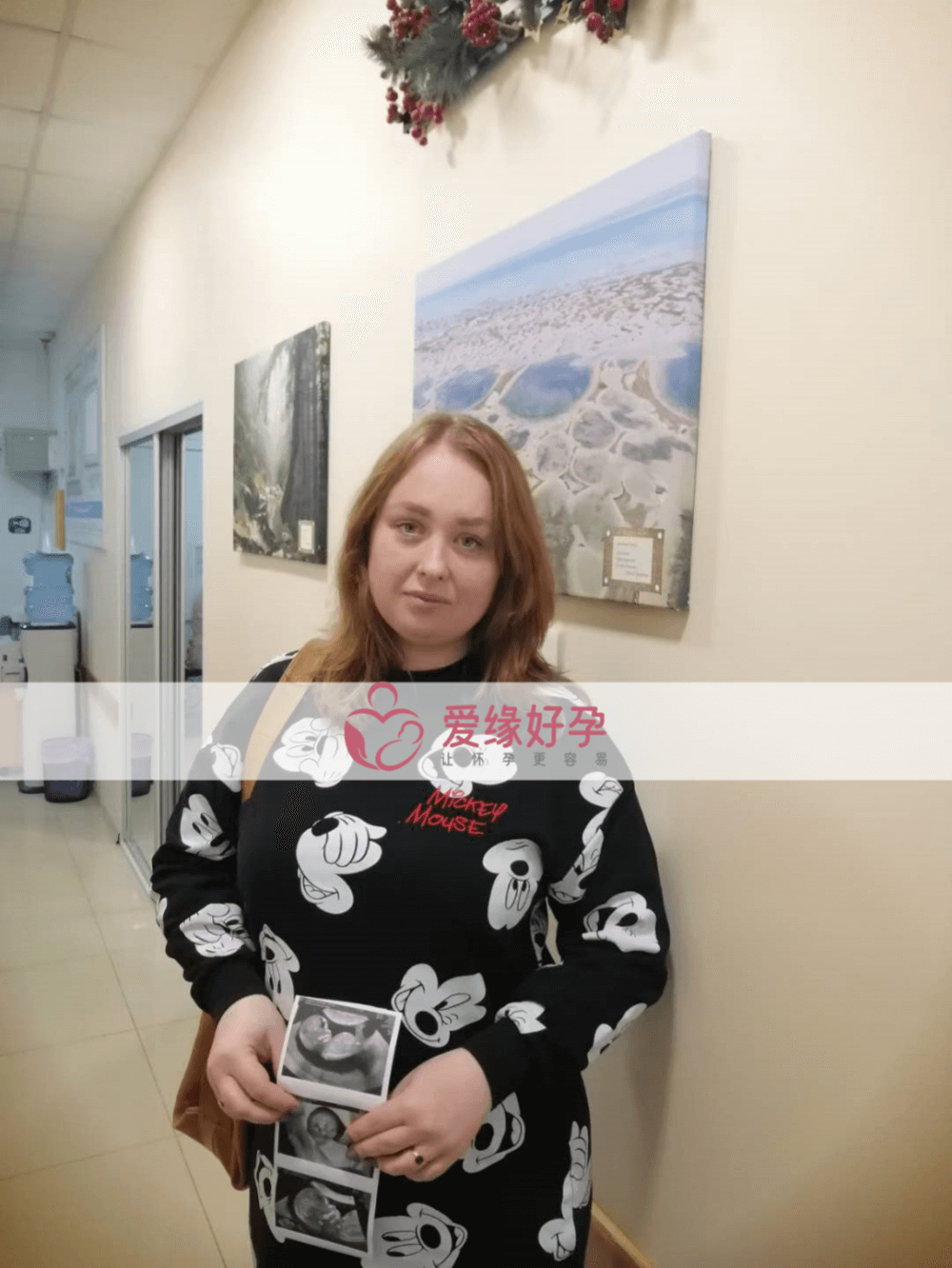 哈萨克斯坦乌克兰试管婴儿助孕爱心妈妈12周NT检测顺利通过！