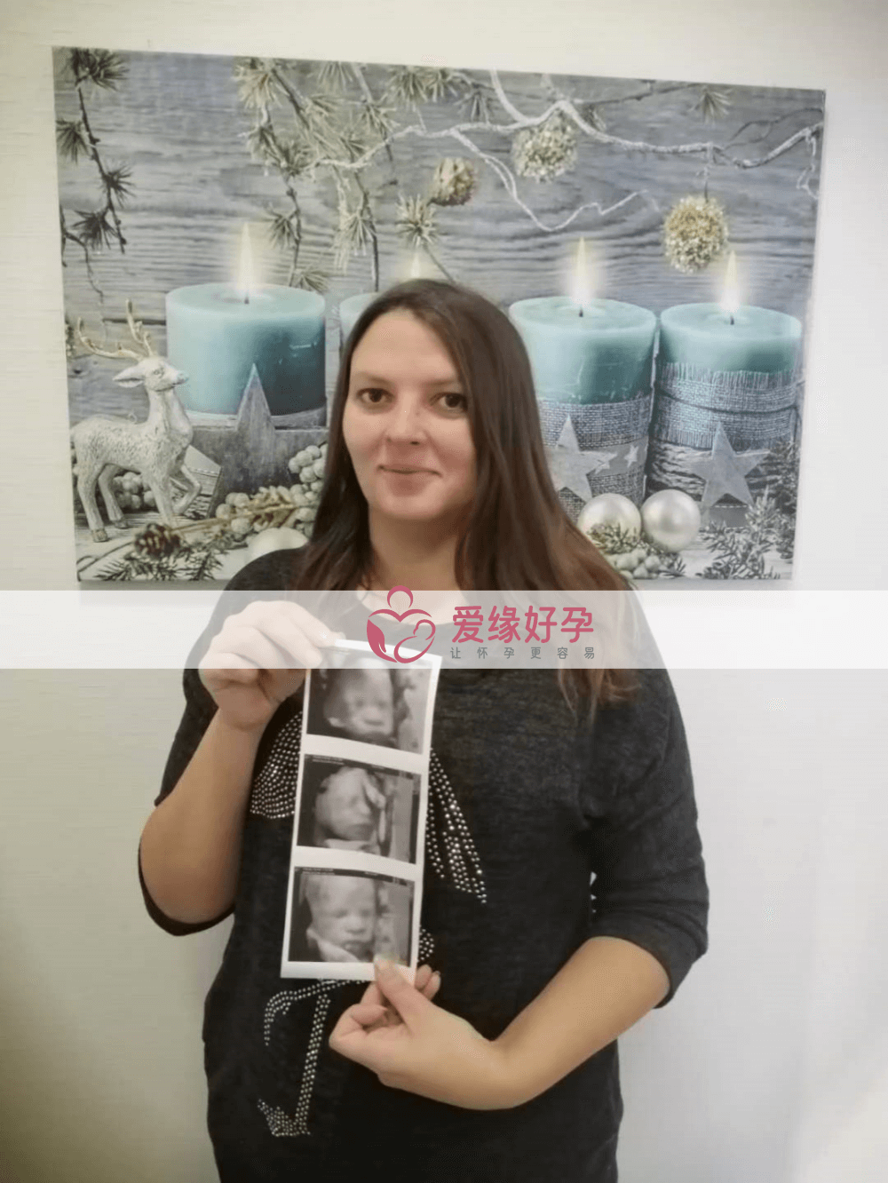 乌克兰哈萨克斯坦是个婴儿助孕爱心妈妈28周产检顺利通过！