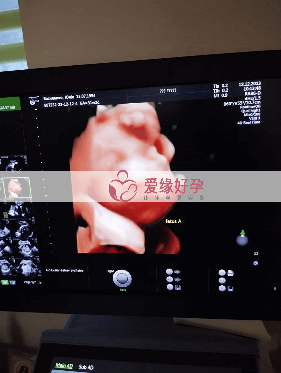 乌克兰试管婴儿助孕爱心妈妈孕29周产检顺利通过