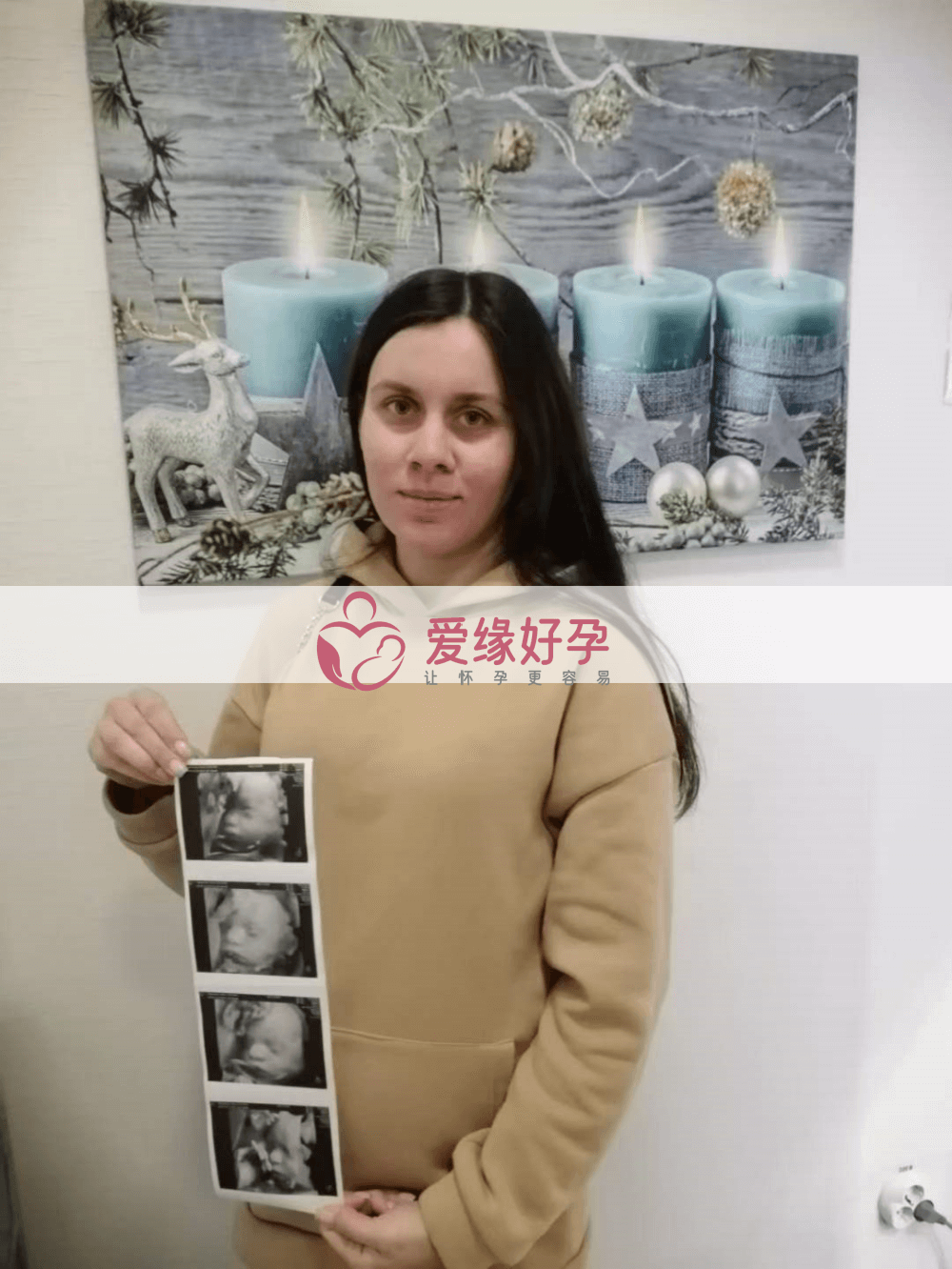 乌克兰试管婴儿助孕爱心妈妈29周产检通过!