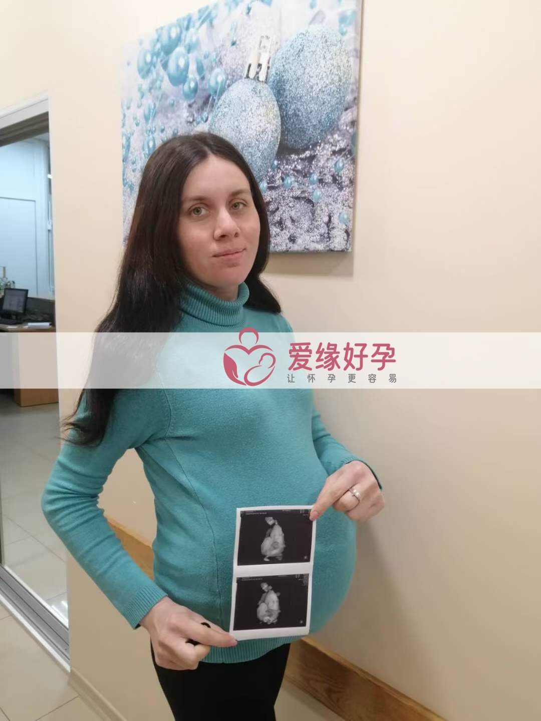 哈萨克斯坦试管婴儿助孕妈妈35周产检顺利通过