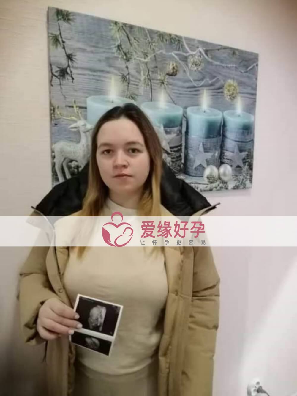 哈萨克斯坦试管婴儿助孕妈妈22周产检通过