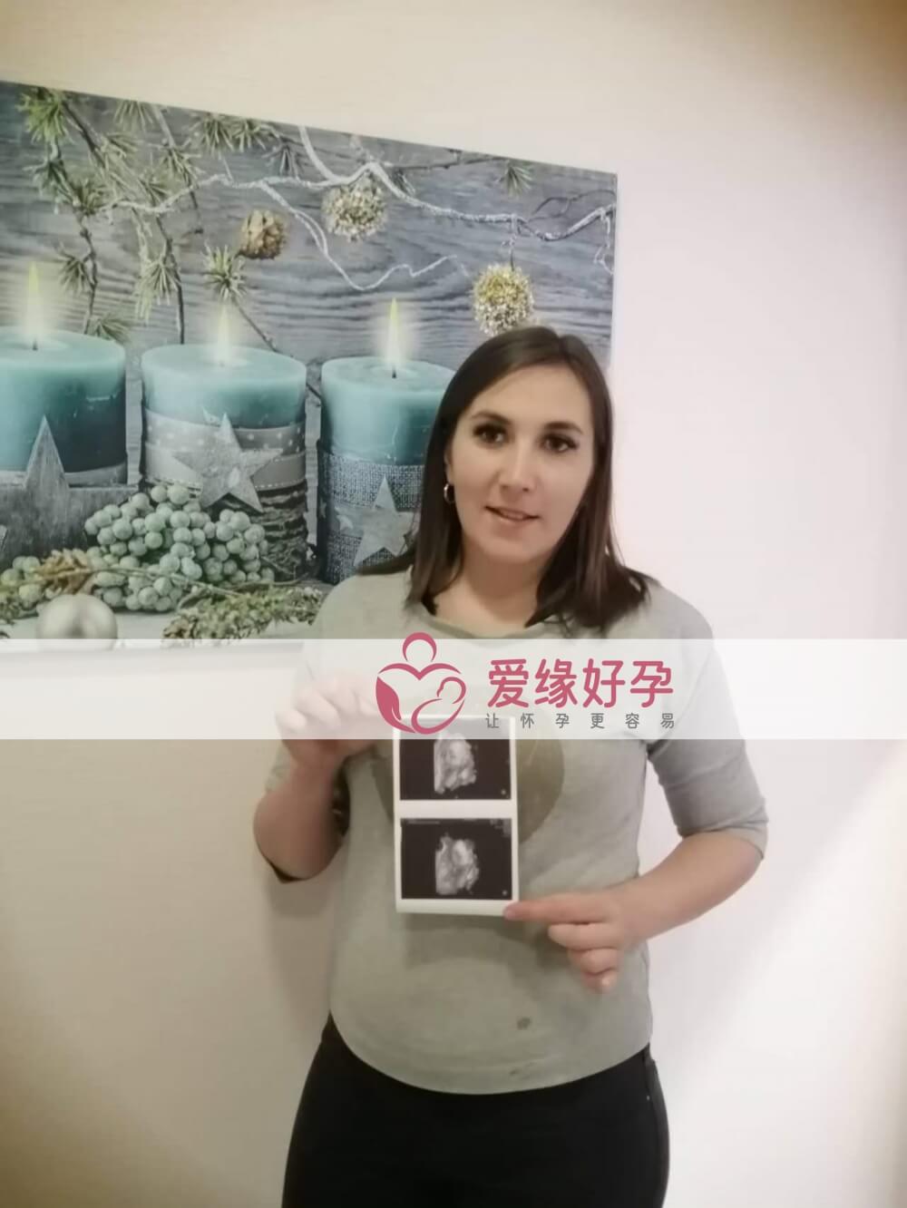 试管婴儿助孕爱心妈妈27周孕检顺利通过