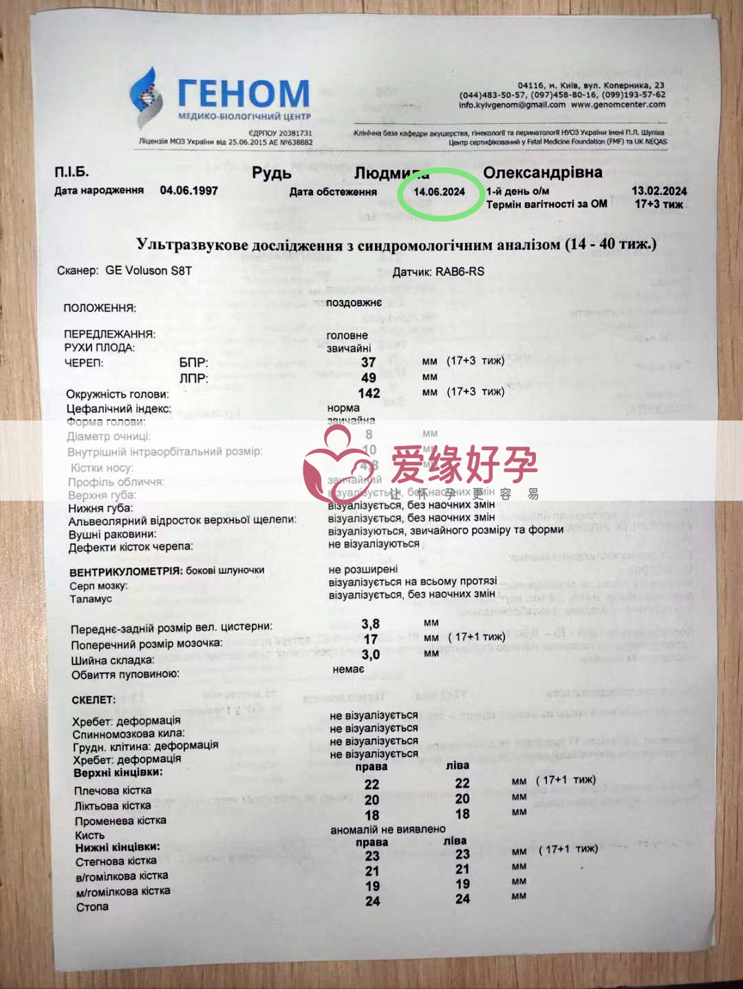 爱缘好孕:乌克兰爱心妈妈孕17周产检顺利通过