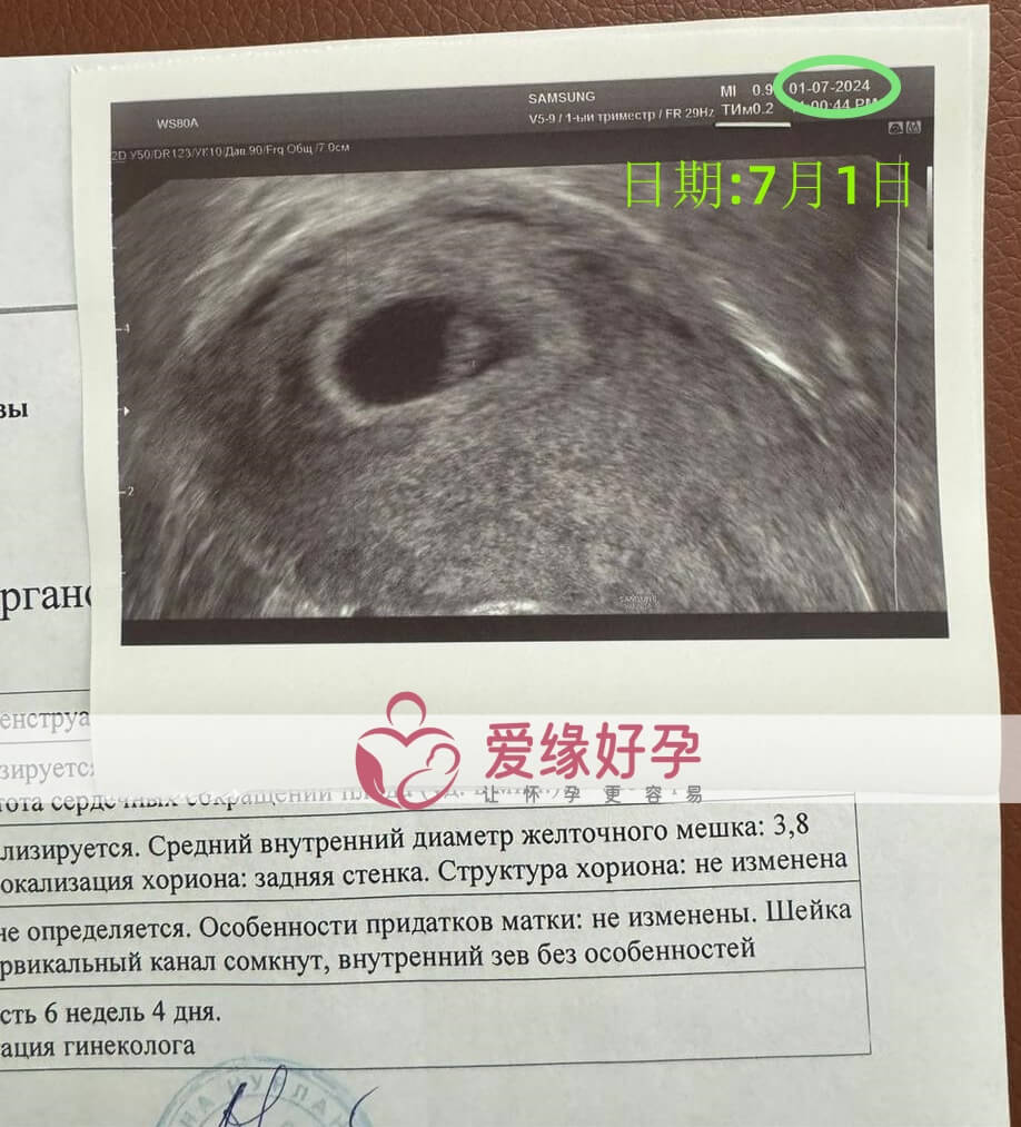 爱缘好孕哈萨克斯坦爱心妈妈孕6周产检顺利通过