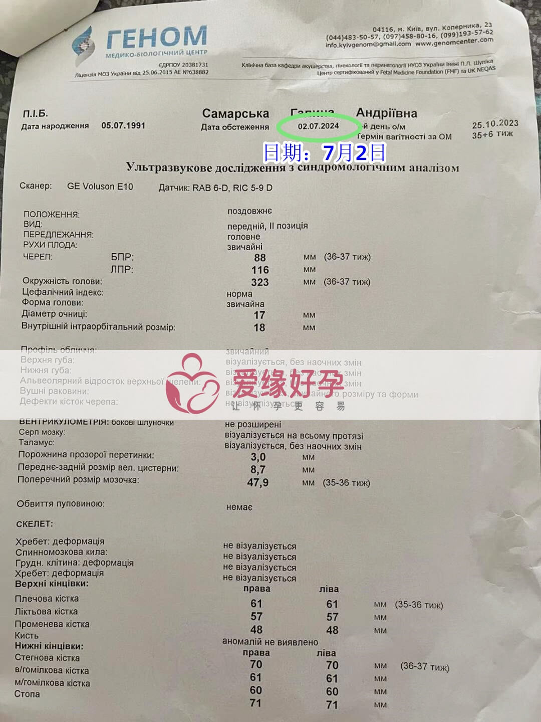 爱缘好孕乌克兰爱心妈妈孕36周产检顺利通过