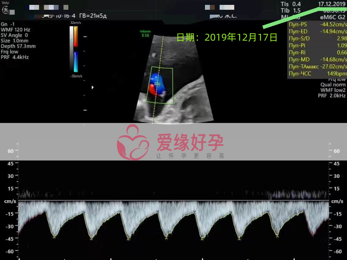 爱缘好孕乌克兰爱心妈妈21周产检顺利通过