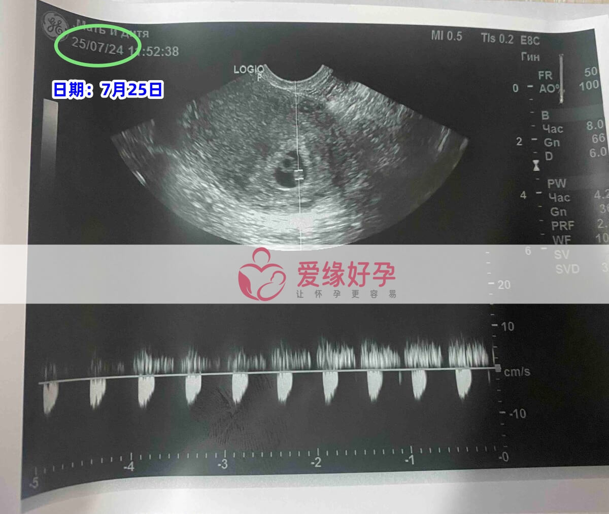 爱缘好孕乌克兰爱心妈妈第一次产检顺利通过