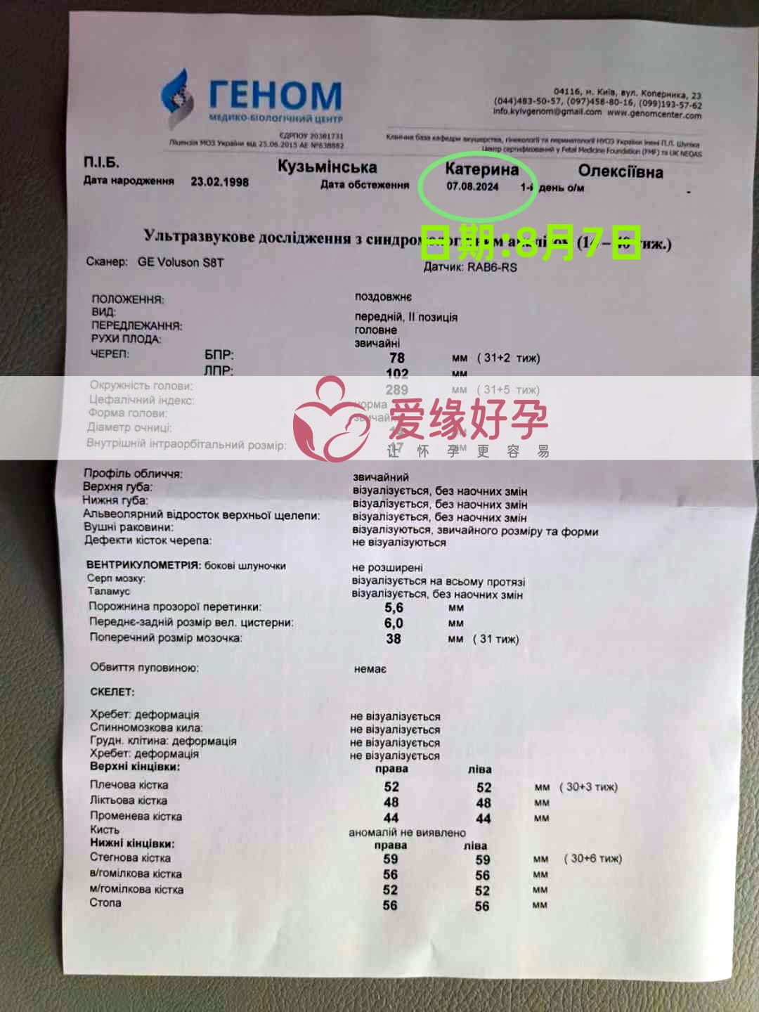 爱缘好孕乌克兰爱心志愿者30周孕检通过！