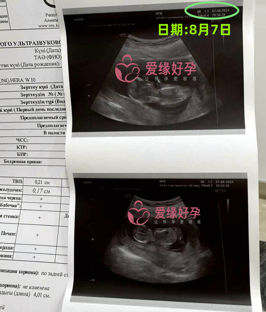 爱缘好孕哈萨克斯坦爱心志愿者12周孕检通过！