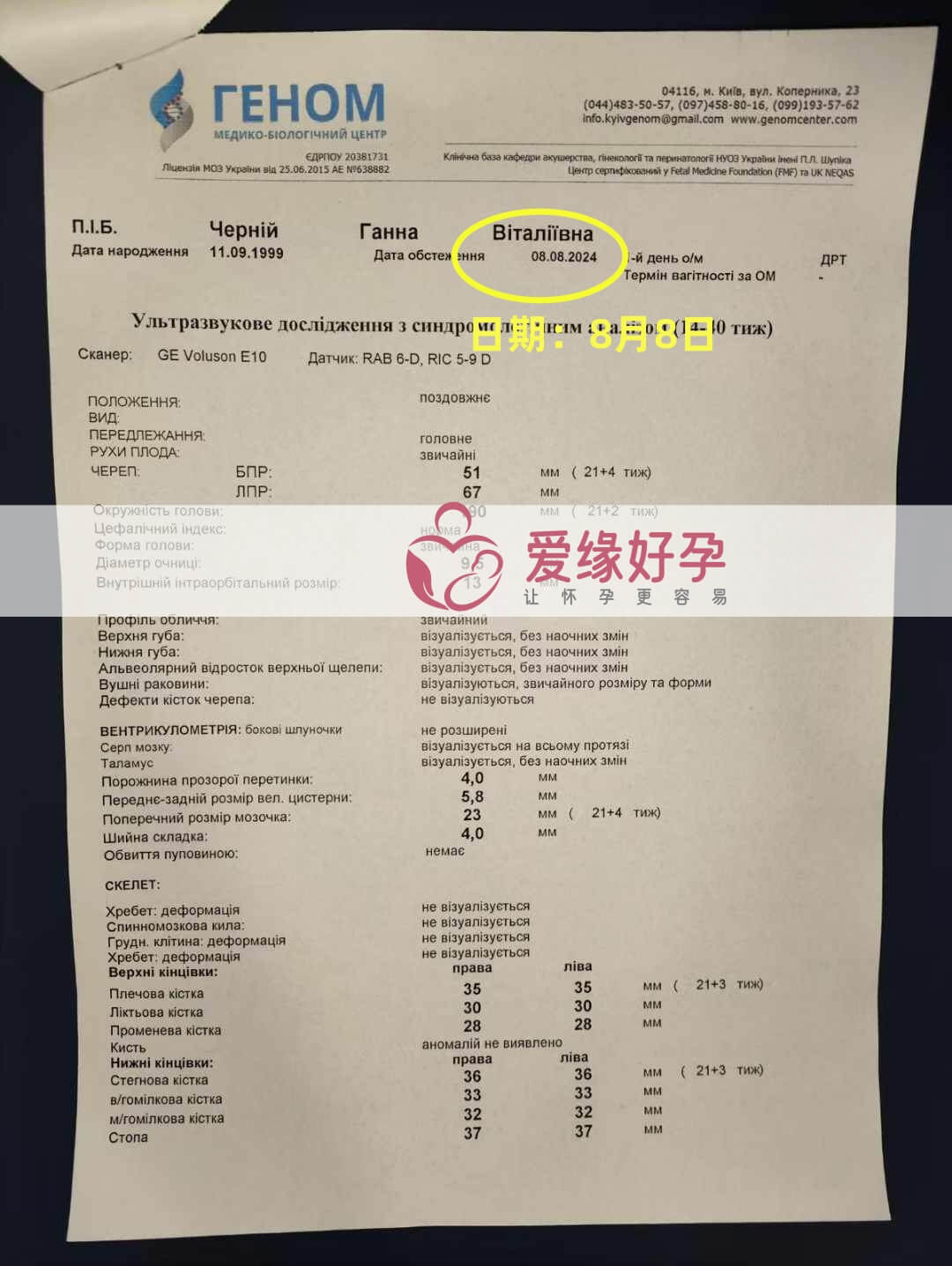 爱缘好孕乌克兰爱心志愿者21周孕检通过！