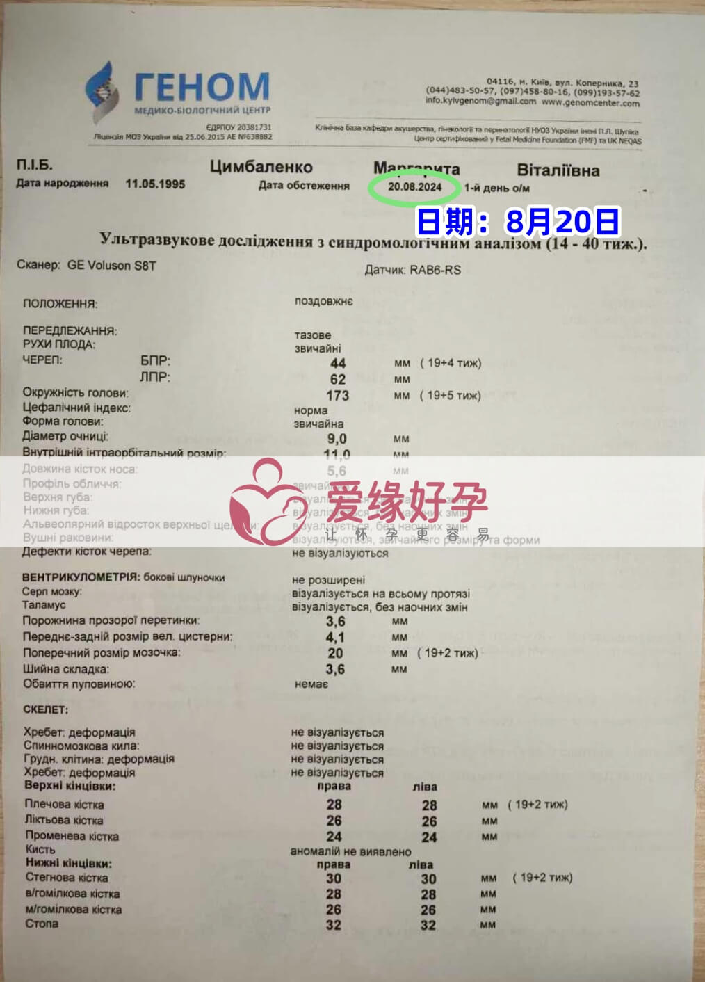 爱缘好孕乌克兰志！愿者孕19周产检顺利通过