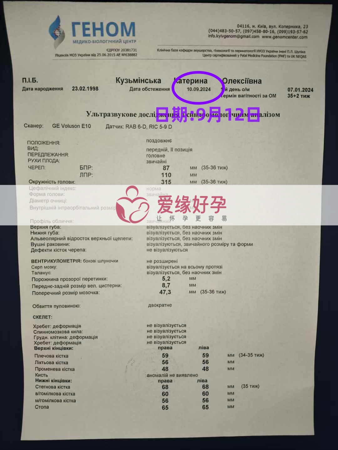 乌克兰爱心使者孕35周产检顺利通过