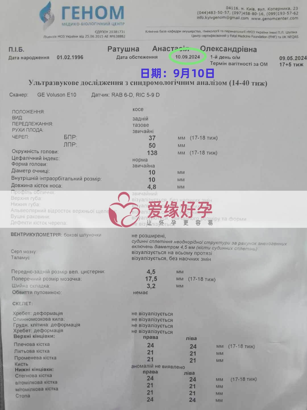 乌克兰爱心使者孕17周产检顺利通过