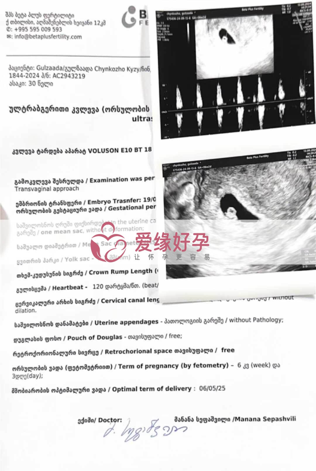 格鲁吉亚爱心志愿者孕6周产检顺利通过