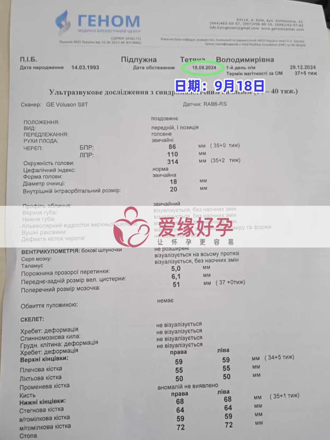 乌克兰爱心志愿者孕35周产检顺利通过