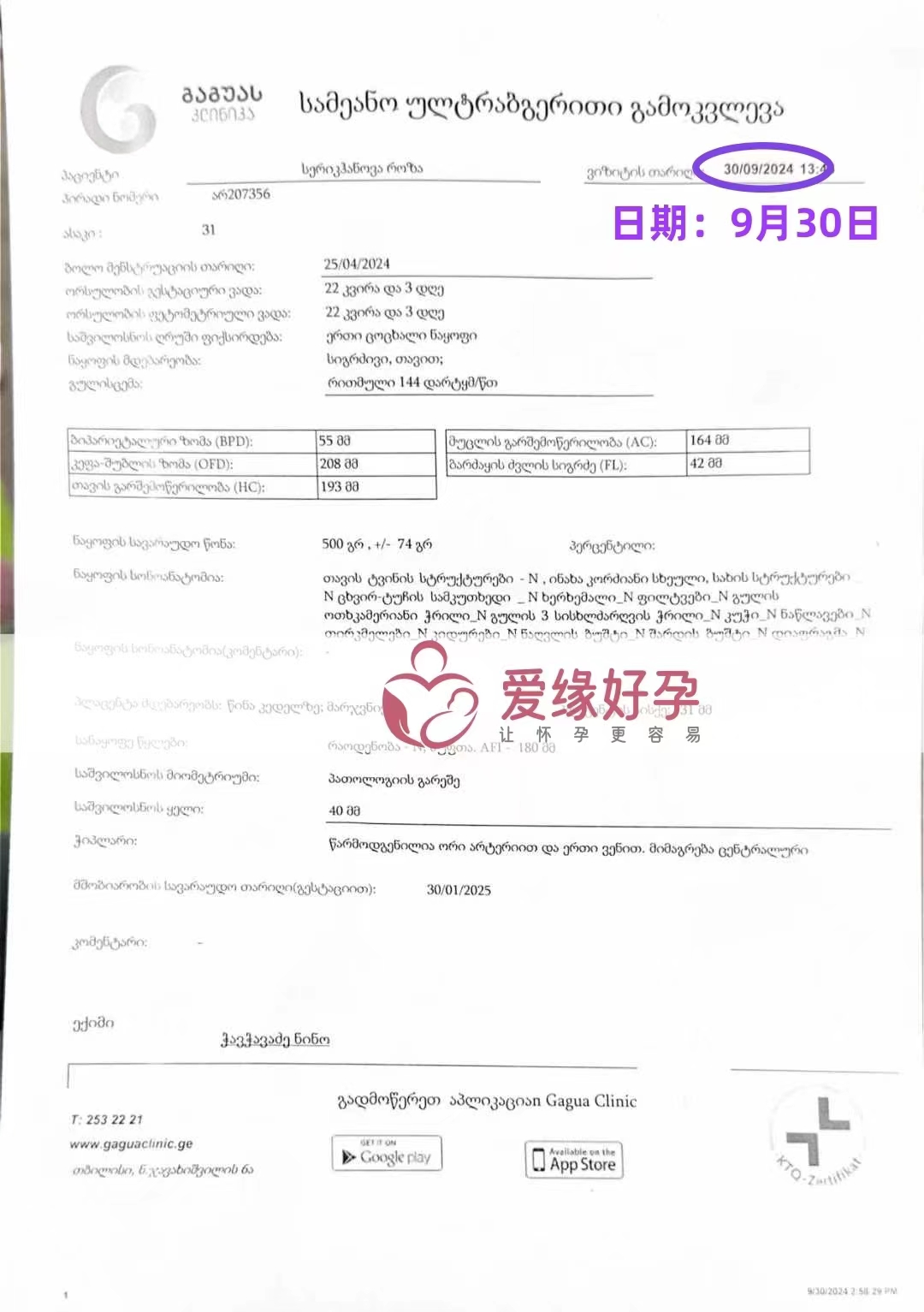 格鲁吉亚爱心使者孕22周产检顺利通过