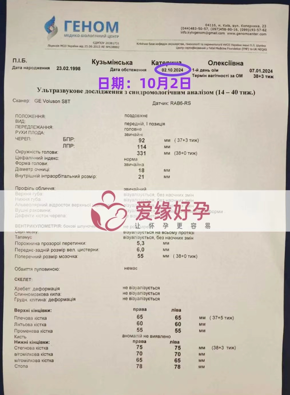 乌克兰爱心使者孕28周产检顺利通过