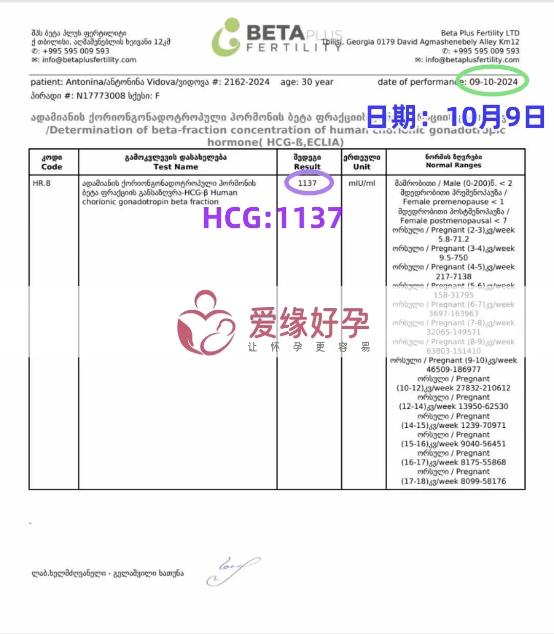 格鲁吉亚爱心使者验孕成功