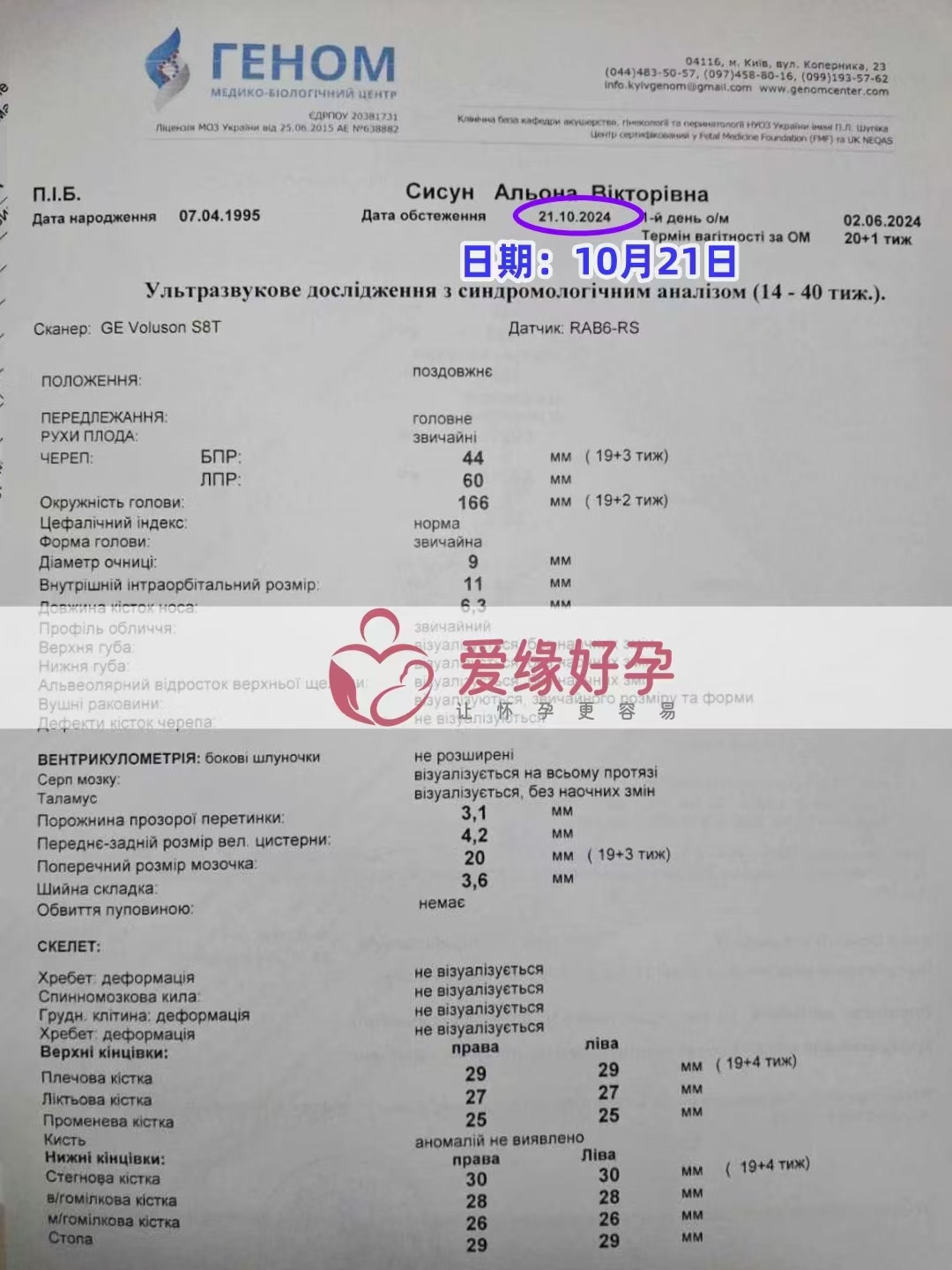 乌克兰爱心使者孕19周产检顺利通过