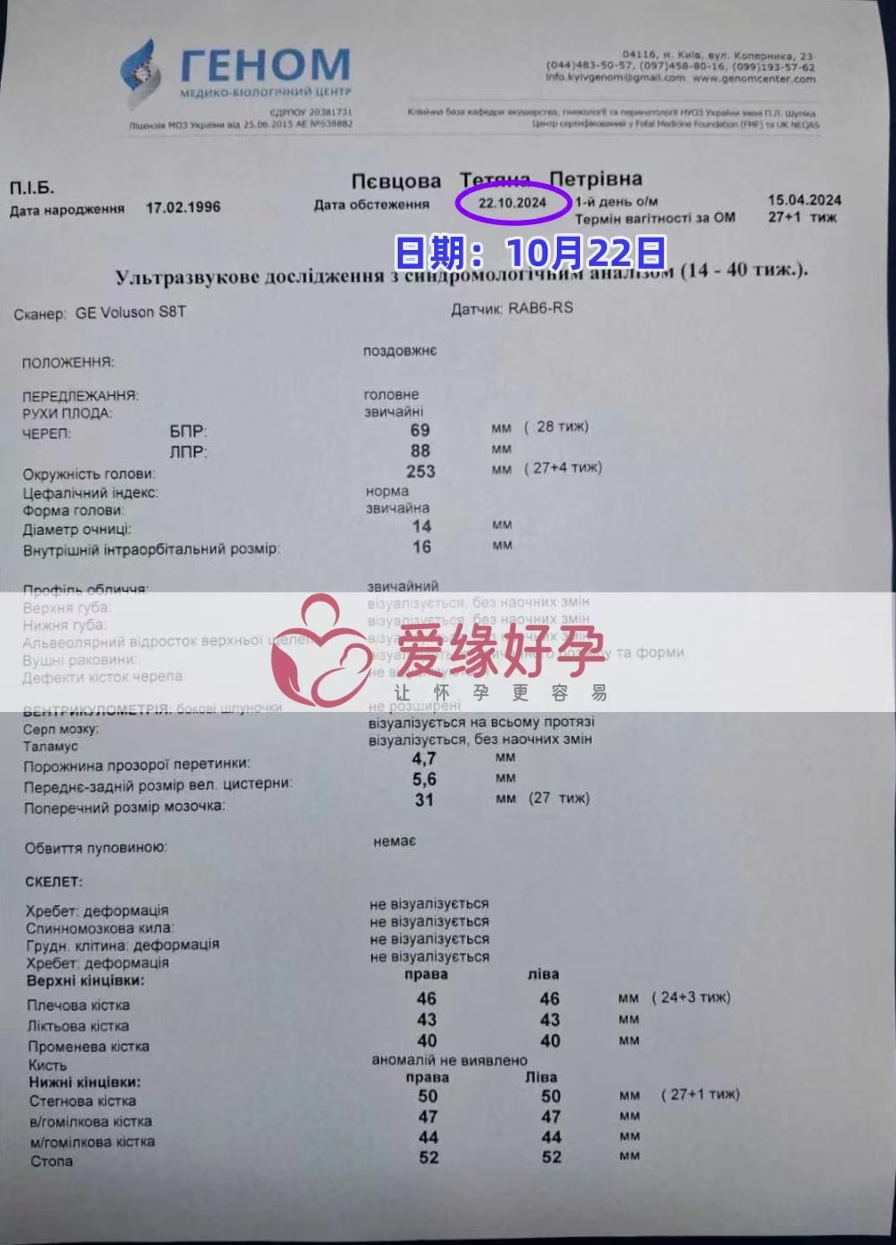 乌克兰爱心使者孕27周产检顺利通过