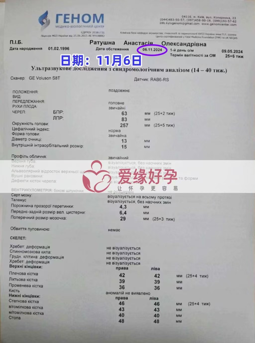 乌克兰爱心使者孕25周产检顺利通过