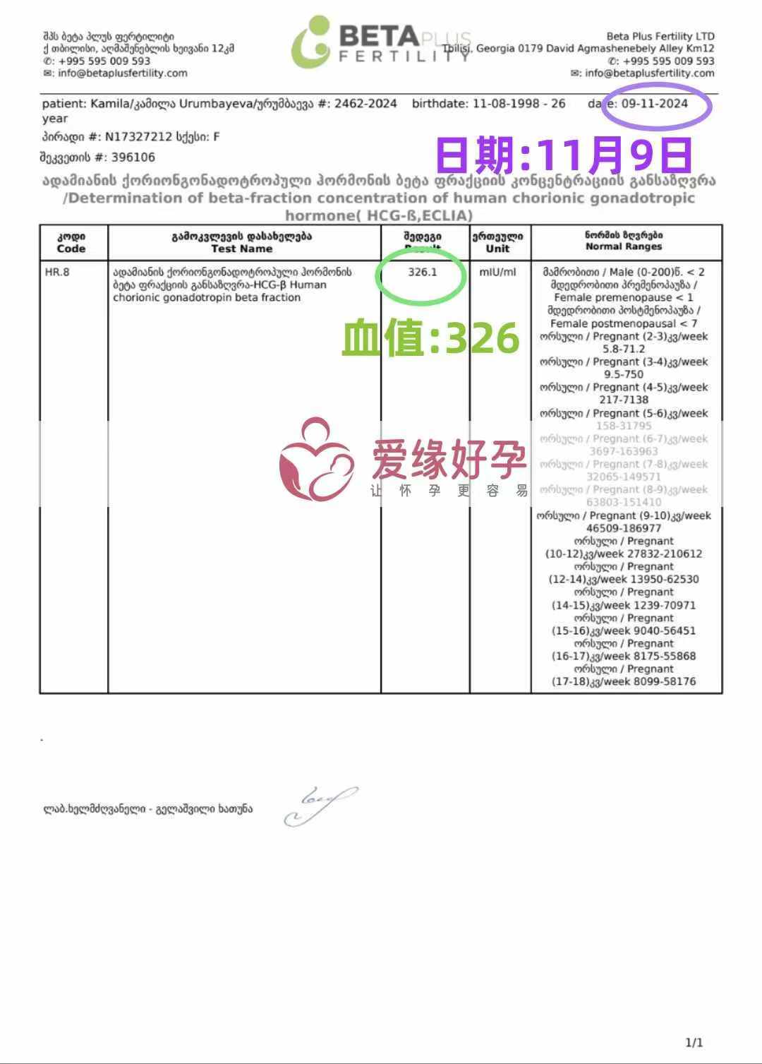 格鲁吉亚爱心使者验孕成功