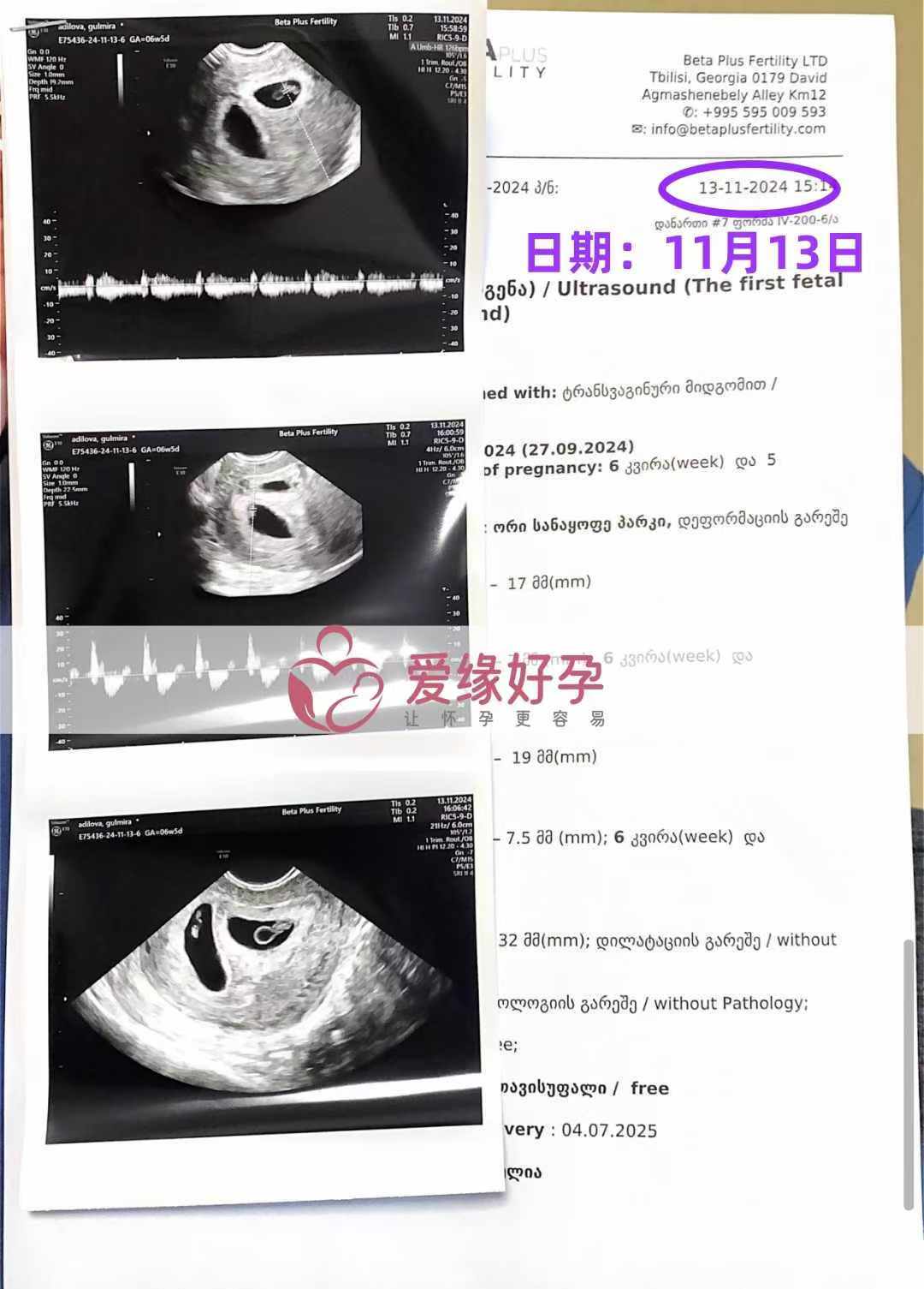 格鲁吉亚爱心使者开奖双胞胎