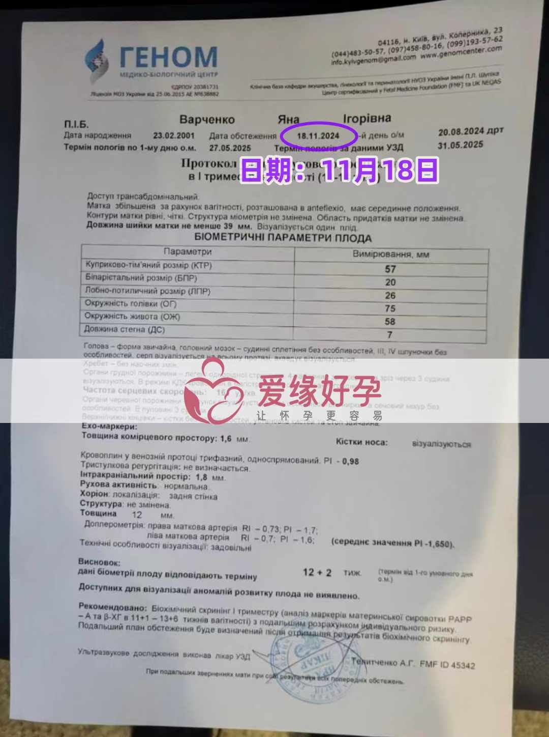 乌克兰爱心使者孕12周产检顺利通过