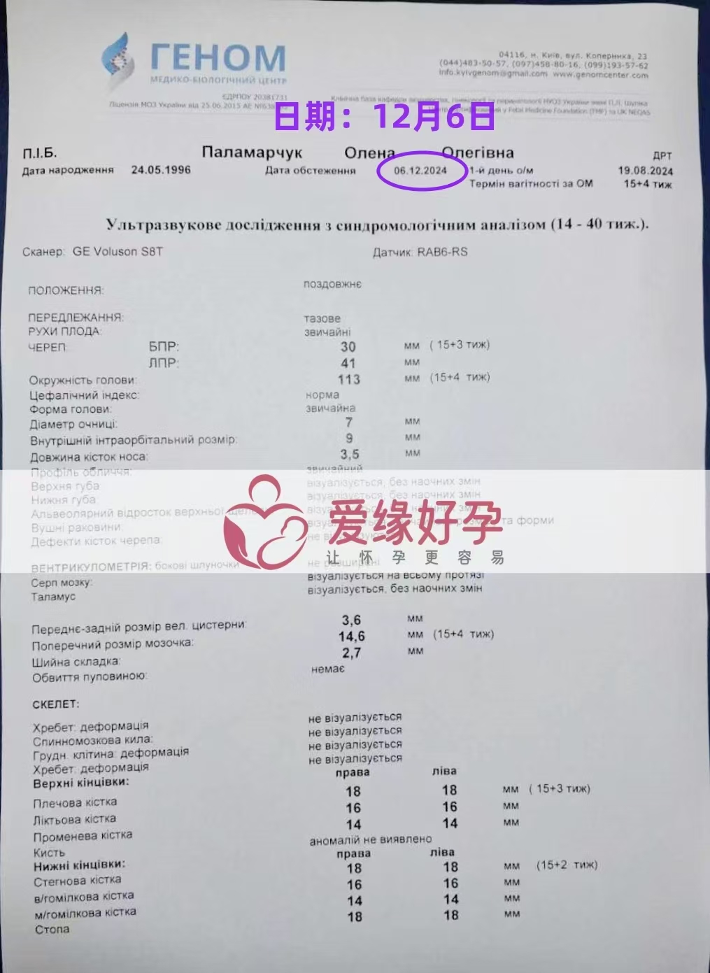 乌克兰爱心使者孕15周产检顺利通过