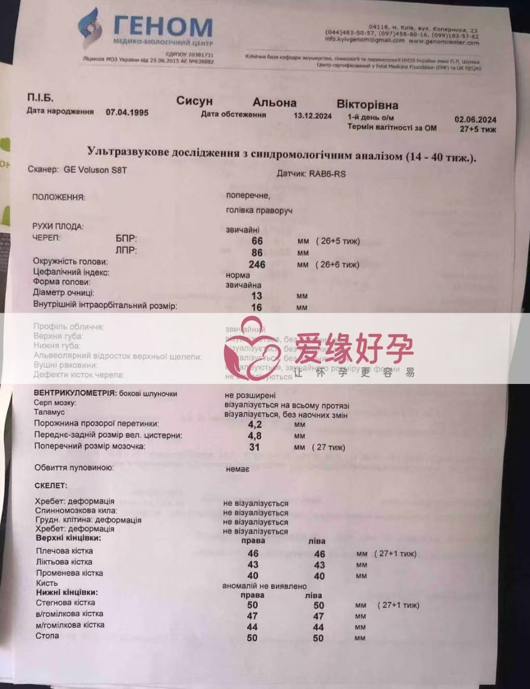 乌克兰爱心使者孕26周大排畸产检顺利通过