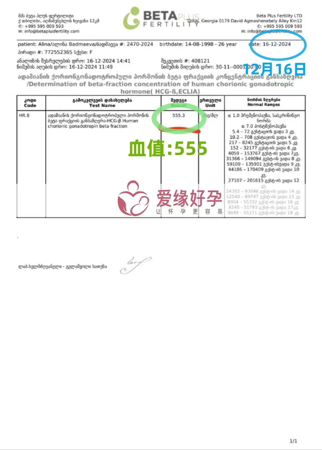 格鲁吉亚爱心使者验孕成功