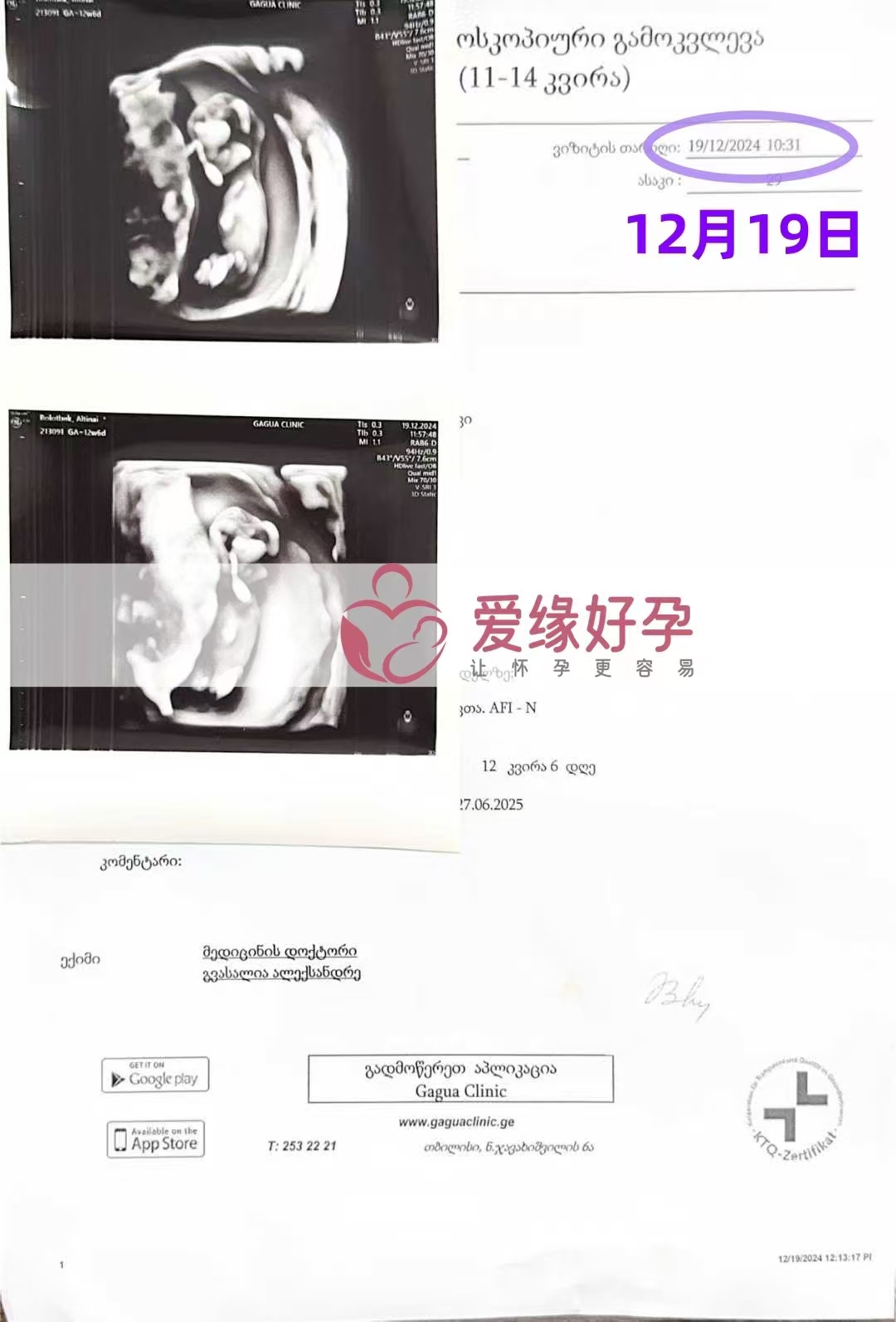 格鲁吉亚爱心使者孕12周产检顺利通过