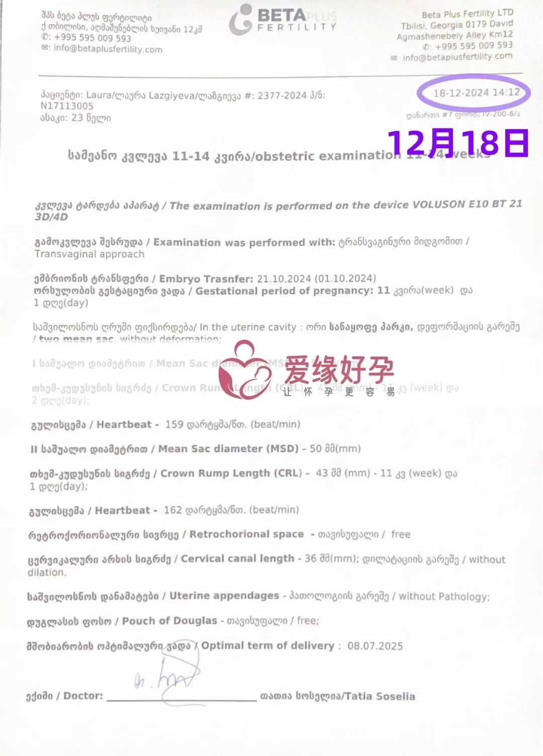 格鲁吉亚爱心使者孕11周产检顺利通过