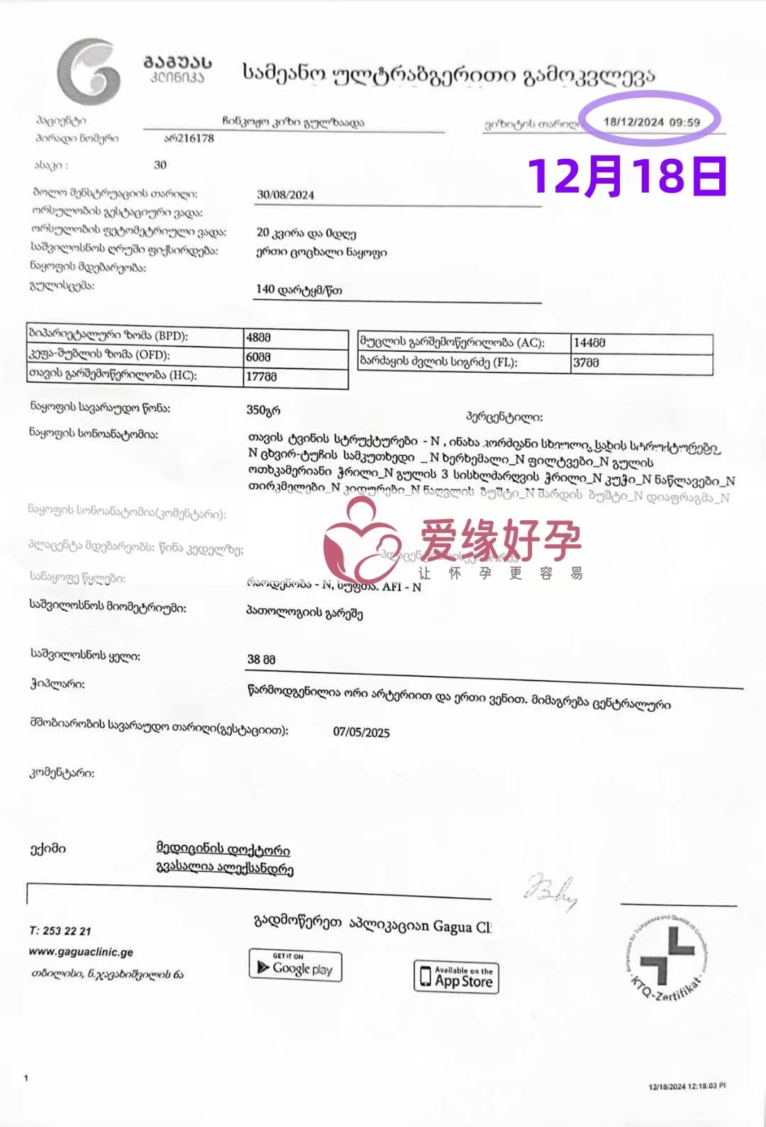 格鲁吉亚爱心使者孕20周产检顺利通过