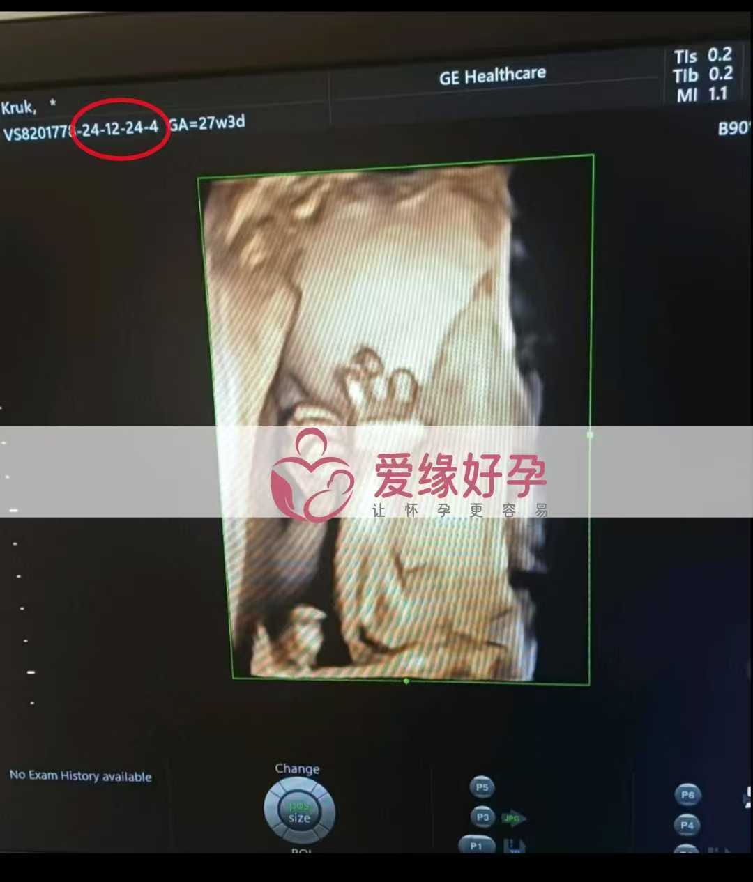 乌克兰爱心使者孕27周产检顺利通过