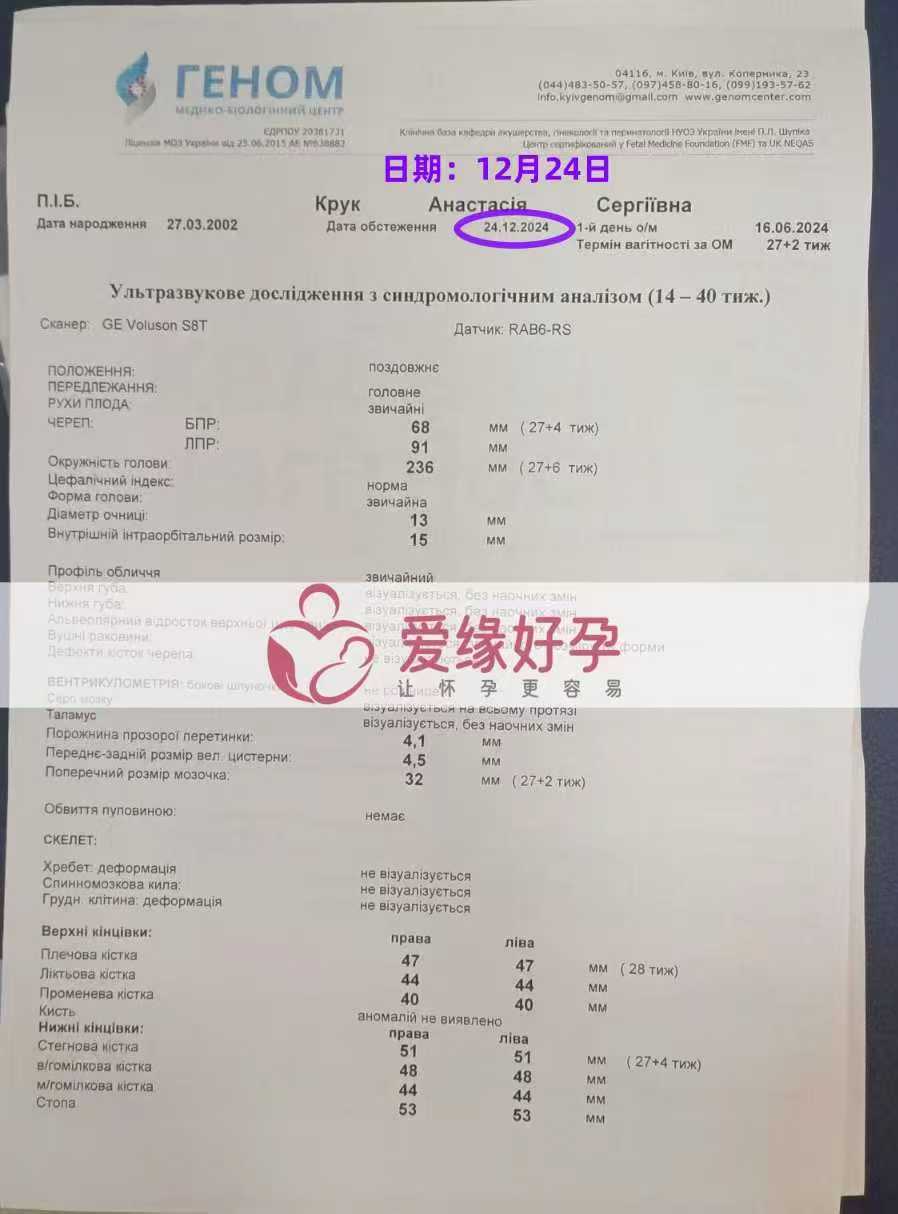 乌克兰爱心使者孕27周产检顺利通过