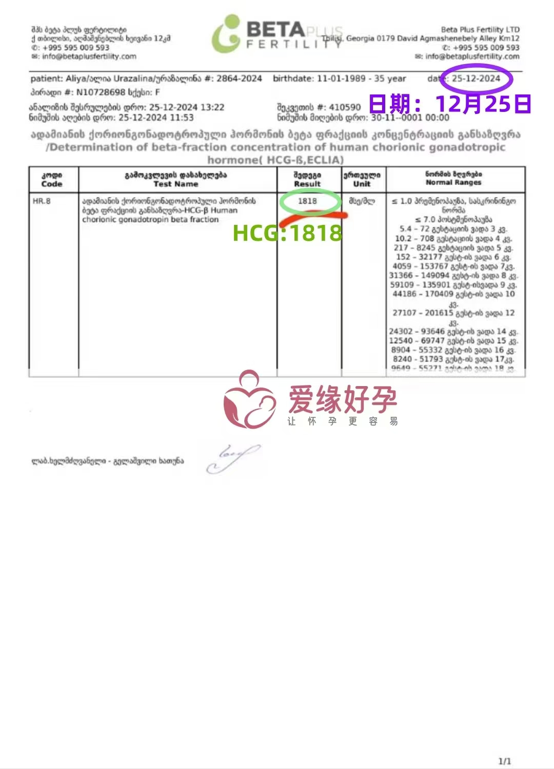 格鲁吉亚爱心使者验孕成功