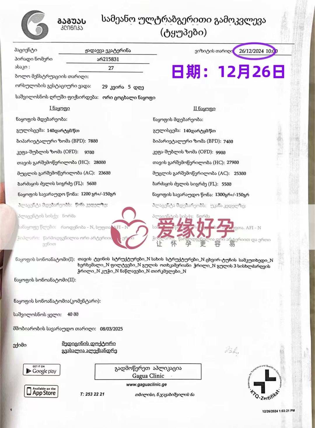 格鲁吉亚爱心使者孕29周双胞胎产检顺利通过