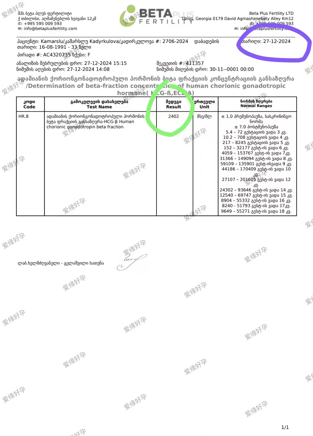 格鲁吉亚爱心使者验孕成功