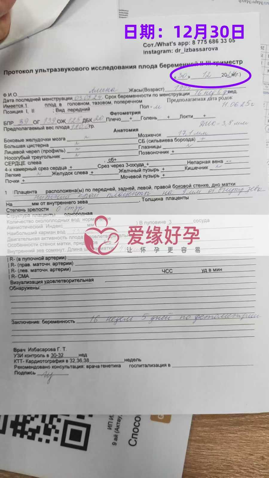 格鲁吉亚爱心使者孕16周产检顺利通过