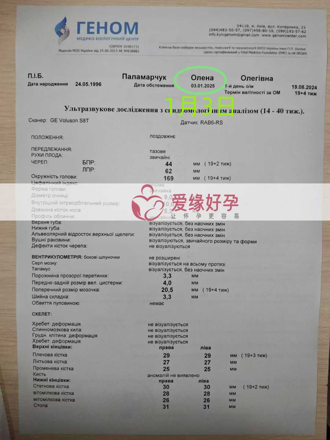 乌克兰爱心使者孕38周产检顺利通过