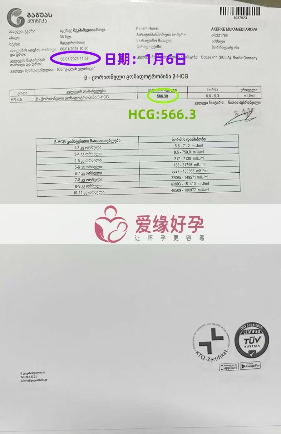 格鲁吉亚爱心使者验孕成功