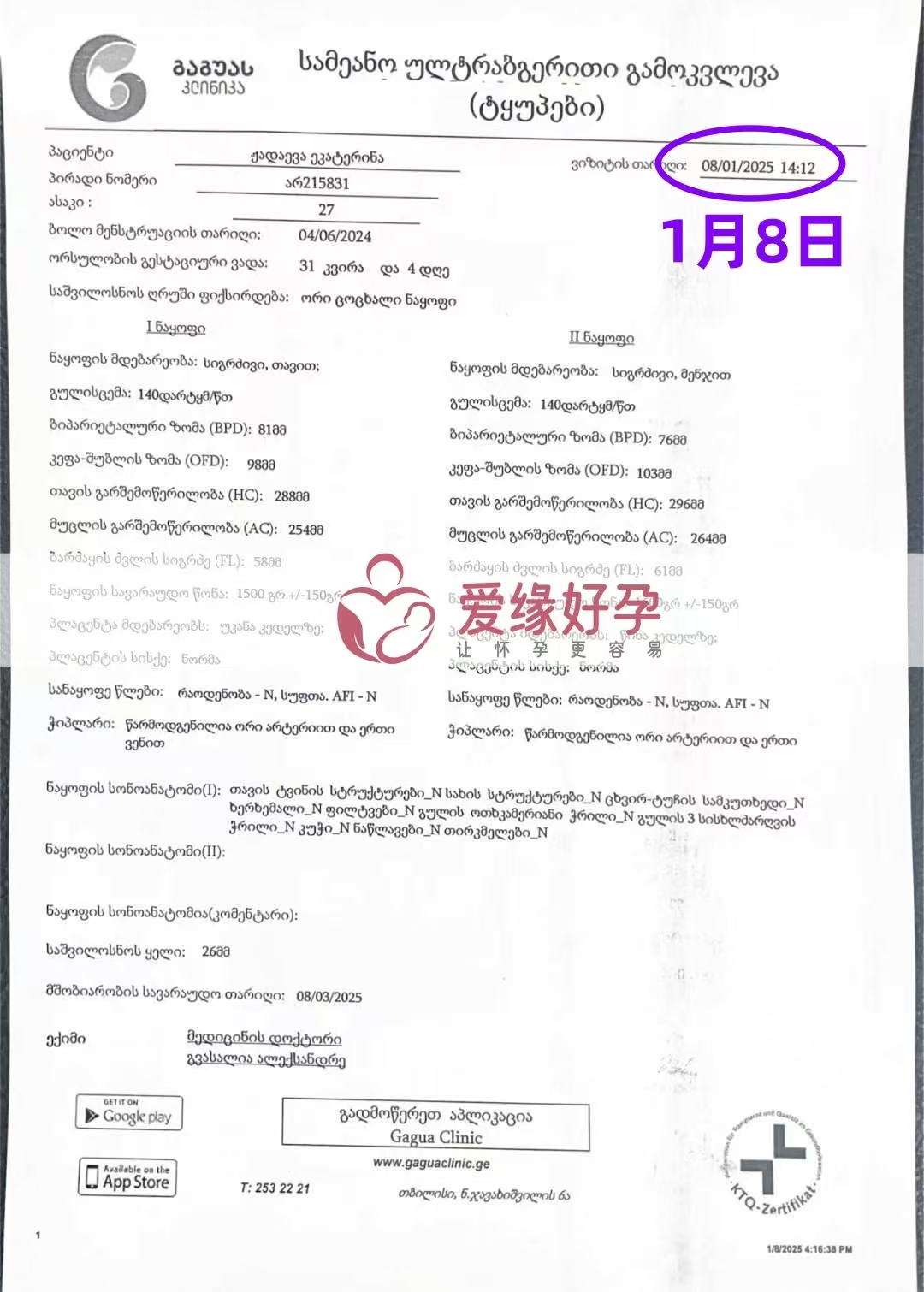 格鲁吉亚双胞胎爱心使者孕31周＋4天产检顺利通过