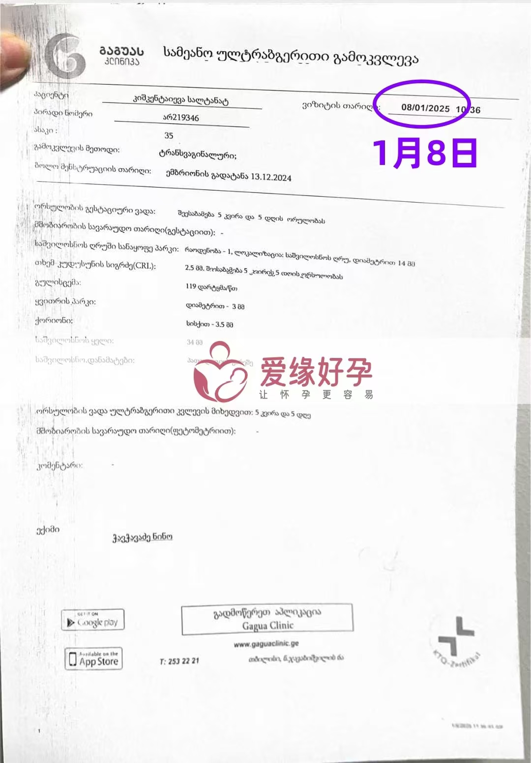 格鲁吉亚爱心使者孕5周＋5天产检顺利通过