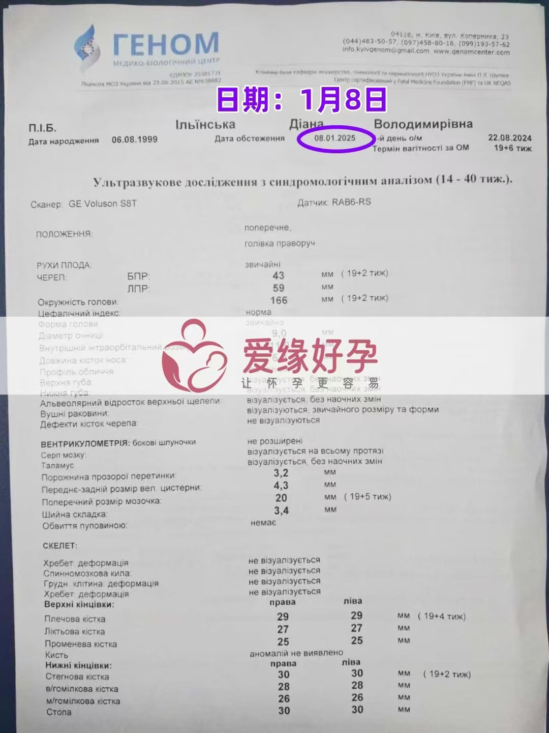 乌克兰爱心使者孕19周产检顺利通过