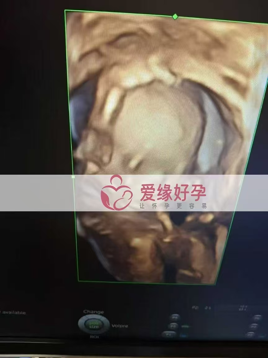 乌克兰爱心使者孕19周产检顺利通过